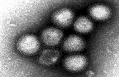 Taiwan confirms 4th imported H7N9 case