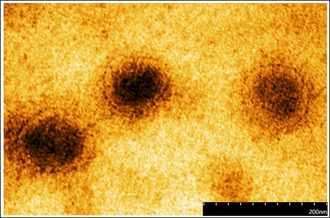 Send viruses to space?