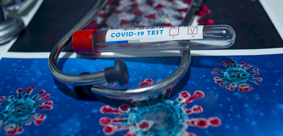 Mass COVID-19 antibody testing report cancelled