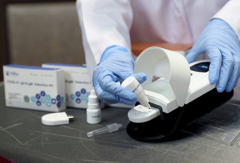 Taipei hospital finds 0.05% of samples with COVID-19 antibodies
